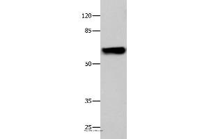 Western blot analysis of 293T cell, using CNGA2 Polyclonal Antibody at dilution of 1:500 (CNGA2 抗体)