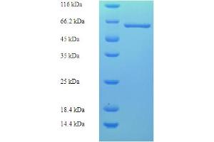 SDS-PAGE (SDS) image for Metastasis Associated 1 (MTA1) (AA 1-429), (full length) protein (His-SUMO Tag) (ABIN5711199)