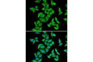 Immunofluorescence (IF) image for anti-Small Nuclear Ribonucleoprotein Polypeptide E (SNRPE) antibody (ABIN1876676) (SNRPE 抗体)