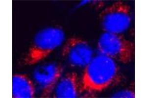 Immunofluorescence (IF) image for anti-Transient Receptor Potential Cation Channel, Subfamily M, Member 7 (TRPM7) (4th Cytoplasmic Loop) antibody (ABIN351218)