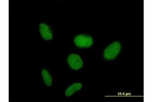 Immunofluorescence of purified MaxPab antibody to ZNF319 on HeLa cell. (ZNF319 抗体  (AA 1-582))