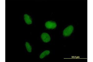 Immunofluorescence of purified MaxPab antibody to ZNF319 on HeLa cell.