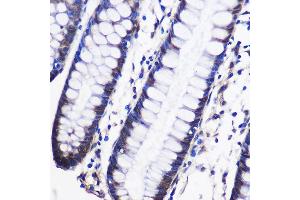 Immunohistochemistry of paraffin-embedded Human colon using CELF1 Rabbit pAb (ABIN6131012, ABIN6138399, ABIN6138400 and ABIN6221641) at dilution of 1:100 (40x lens).