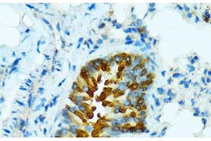 Immunohistochemistry of paraffin-embedded Mouse lung using CYP2B6 Polyclonal Antibody at dilution of 1:100 (40x lens). (CYP2B6 抗体)