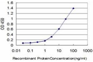 Detection limit for recombinant GST tagged ERN1 is approximately 0. (ERN1 抗体  (AA 401-500))