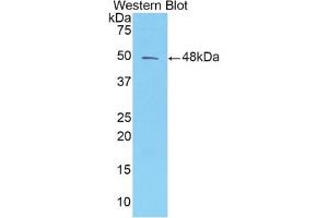 Western blot analysis of the recombinant protein. (AMBP 抗体  (AA 20-202))