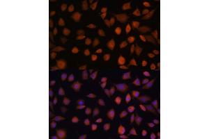 Immunofluorescence analysis of L929 cells using  antibody (ABIN7265674) at dilution of 1:100. (ARMC6 抗体  (AA 1-220))