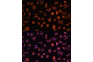 Immunofluorescence analysis of L929 cells using  antibody (ABIN7265674) at dilution of 1:100. (ARMC6 抗体  (AA 1-220))