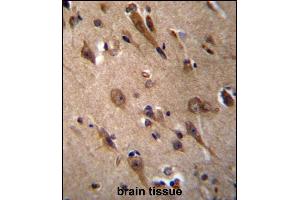 Immunohistochemistry (Paraffin-embedded Sections) (IHC (p)) image for anti-Resistance To Inhibitors of Cholinesterase 3 Homolog (RIC3) (AA 313-341), (C-Term) antibody (ABIN656649)