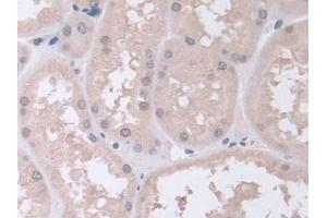 Immunohistochemistry (IHC) image for anti-Proteasome Subunit alpha 5 (PSMA5) (AA 1-241) antibody (ABIN7441322)