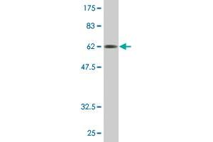 Western Blotting (WB) image for anti-Fc Fragment of IgE, Low Affinity II, Receptor For (CD23) (FCER2) (AA 1-321) antibody (ABIN515558)