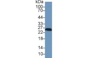 Western Blotting (WB) image for anti-Ubiquitin Carboxyl-terminal Esterase L1 (Ubiquitin Thiolesterase) (UCHL1) (AA 2-223) antibody (ABIN7436393)