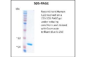 SDS-PAGE (SDS) image for Interleukin 22 (IL22) (Active) protein (ABIN5509407) (IL-22 蛋白)