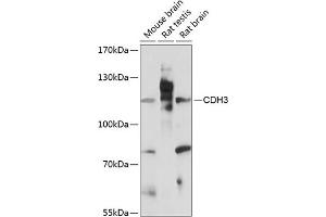 Western blot analysis of extracts of various cell lines, using CDH3 antibody (ABIN7269142) at 1:3000 dilution. (P-Cadherin 抗体  (AA 24-350))