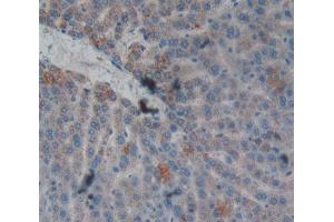 Used in DAB staining on fromalin fixed paraffin- embedded liver tissue (CPB2 抗体  (AA 164-417))
