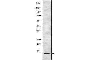 Western blot analysis IFI27 using Jurkat whole cell lysates (IFI27 抗体  (N-Term))