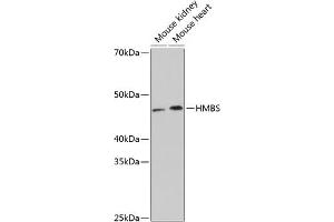 Western blot analysis of extracts of various cell lines, using HMBS Rabbit mAb (ABIN7267806) at 1:1000 dilution. (HMBS 抗体)