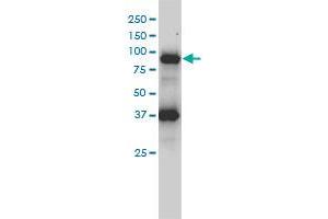 FES monoclonal antibody (M01), clone 3A3-1E5 Western Blot analysis of FES expression in HL-60 .