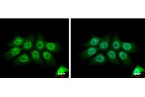ICC/IF Image TMS1 antibody [N1C3] detects TMS1 protein at cytoplasm and nucleus by immunofluorescent analysis. (PYCARD 抗体)