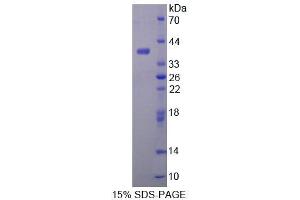 SDS-PAGE analysis of Mouse ALDH1A1 Protein. (ALDH1A1 蛋白)