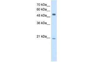 WB Suggested Anti-BLK Antibody Titration:  2. (BLK 抗体  (Middle Region))
