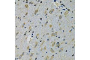 Immunohistochemistry of paraffin-embedded mouse brain using RPS12 antibody. (RPS12 抗体  (AA 1-132))