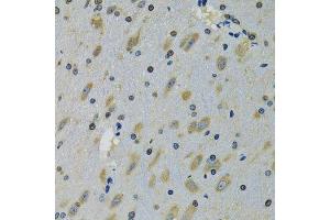 Immunohistochemistry of paraffin-embedded mouse brain using RPS12 antibody. (RPS12 抗体  (AA 1-132))