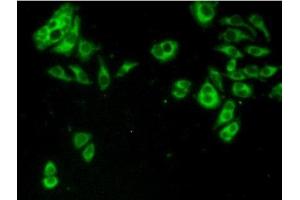 Detection of TACR2 in Hela cells using Polyclonal Antibody to Tachykinin Receptor 2 (TACR2) (TACR2 抗体  (AA 92-290))