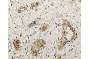 ABIN6276910 at 1/100 staining human lung tissue sections by IHC-P. (Surfactant Protein C 抗体  (N-Term))