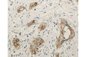 ABIN6276910 at 1/100 staining human lung tissue sections by IHC-P.