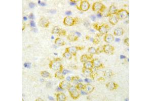 Anti-FGF9 antibody, IHC(P) IHC(P): Rat Brain Tissue (FGF9 抗体  (Middle Region))