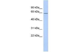 WB Suggested Anti-RNPC3 Antibody Titration:  0. (RNP 抗体  (Middle Region))