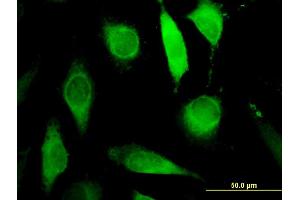 Immunofluorescence of monoclonal antibody to AGPAT6 on HeLa cell.