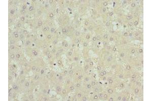 Immunohistochemistry of paraffin-embedded human liver tissue using ABIN7174262 at dilution of 1:100 (USP15 抗体  (C-Term))