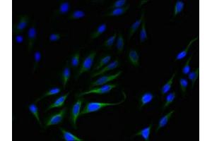 Immunofluorescent analysis of Hela cells using ABIN7170235 at dilution of 1:100 and Alexa Fluor 488-congugated AffiniPure Goat Anti-Rabbit IgG(H+L) (SLC35F5 抗体  (AA 122-242))