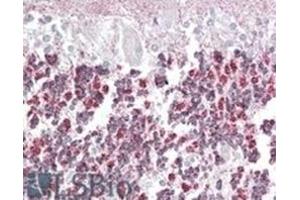 Image no. 2 for anti-Epilepsy, Progressive Myoclonus Type 2A, Lafora Disease (Laforin) (EPM2A) (Internal Region), (Isoform A) antibody (ABIN375087) (EPM2A 抗体  (Internal Region, Isoform A))