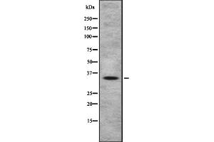 Western blot analysis OR4A47 using HeLa whole cell lysates (OR4A47 抗体  (Internal Region))