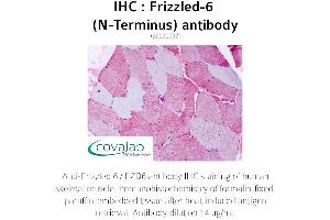 Image no. 1 for anti-Frizzled Family Receptor 6 (FZD6) (Extracellular Domain), (N-Term) antibody (ABIN1734469) (FZD6 抗体  (Extracellular Domain, N-Term))
