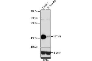 Western blot analysis of extracts from normal (control) and IFITM3 knockout (KO) HeLa cells, using IFITM3 antibody (ABIN6130482, ABIN6142186, ABIN6142187 and ABIN7101416) at 1:3000 dilution. (IFITM3 抗体  (AA 1-133))