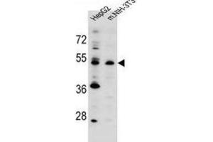 Western Blotting (WB) image for anti-Potassium Channel Modulatory Factor 1 (KCMF1) antibody (ABIN2996241) (KCMF1 抗体)