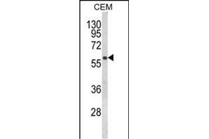 Western blot analysis of FLCN Antibody (Center) (ABIN652602 and ABIN2842404) in CEM cell line lysates (35 μg/lane). (FLCN 抗体  (AA 325-354))