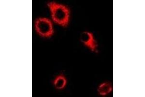 Immunofluorescent analysis of SerRS staining in MCF7 cells. (Seryl-tRNA Synthetase (SARS) 抗体)