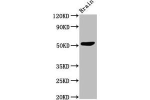 Western Blot Positive WB detected in: Mouse brain tissue All lanes: SLC30A10 antibody at 3 μg/mL Secondary Goat polyclonal to rabbit IgG at 1/50000 dilution Predicted band size: 53, 27, 25 kDa Observed band size: 53 kDa (SLC3A1 抗体  (AA 58-278))