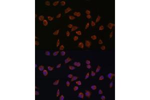 Immunofluorescence analysis of L929 cells using  antibody (ABIN7265426) at dilution of 1:100. (ACSS1 抗体  (AA 340-689))