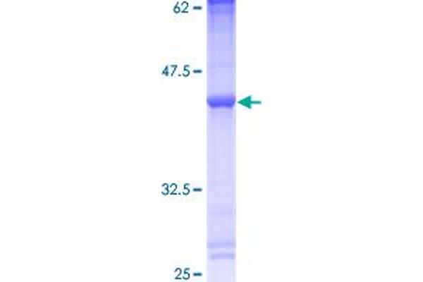 PLA2G5 Protein (AA 1-138) (GST tag)