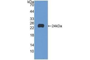 Detection of Recombinant SCFR, Human using Polyclonal Antibody to Stem Cell Factor Receptor (SCFR) (KIT 抗体  (AA 321-520))