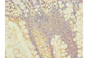 Immunohistochemistry of paraffin-embedded human small intestine tissue using ABIN7143534 at dilution of 1:100 (SLC25A4 抗体  (AA 40-74))