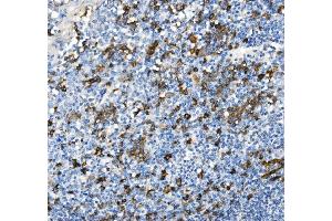 IHC analysis of CD38 using anti-CD38 antibody (ABIN7602815).
