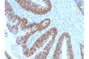 Immunohistochemistry (IHC) image for anti-Caudal Type Homeobox 2 (CDX2) (AA 150-249) antibody (ABIN6939060)