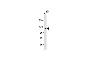Anti-SNX13 Antibody (C-term) at 1:1000 dilution + Hela whole cell lysate Lysates/proteins at 20 μg per lane. (SNX13 抗体  (C-Term))